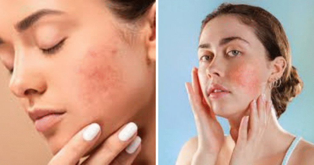 Sensitive Skin